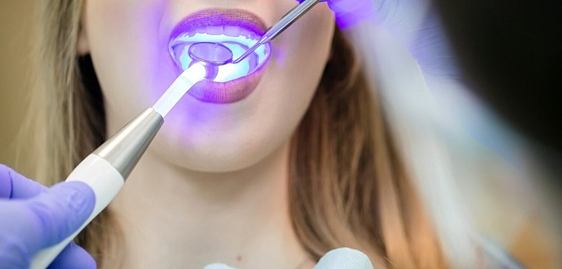 Biała dieta po wybielaniu zębów - co jeść, a czego unikać?