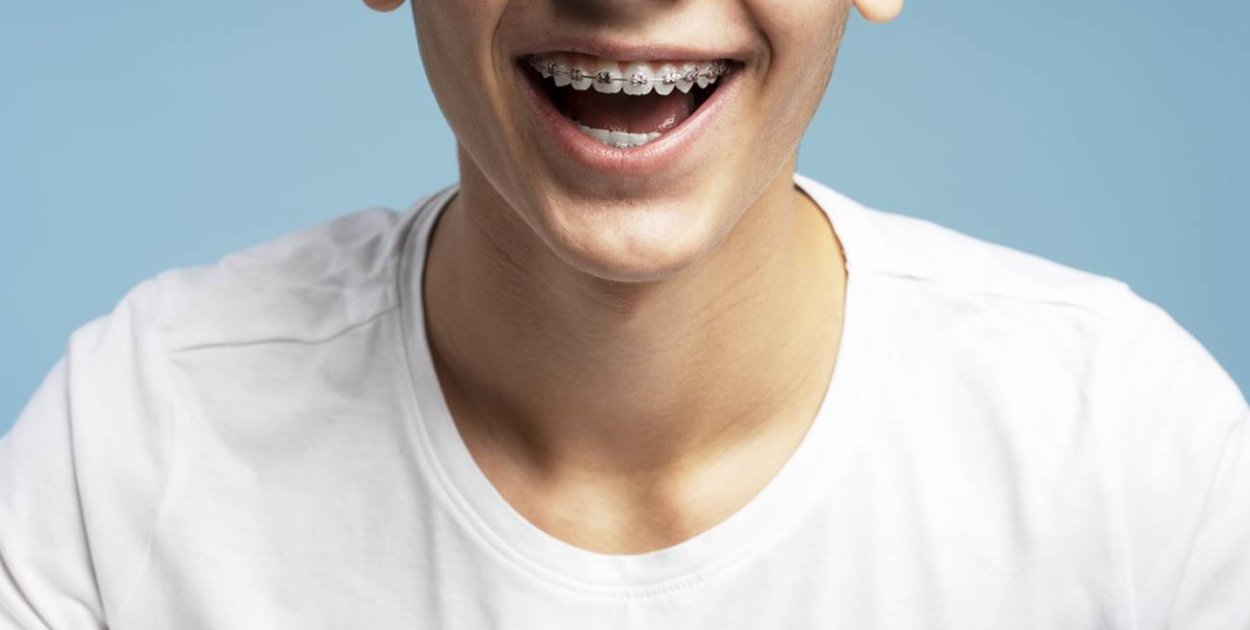 Innowacyjne metody ortodoncji – Dowiedz się więcej - fot. partnera